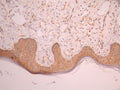 IHC image of CSB-RA272247A0HU diluted at 1:100 and staining in paraffin-embedded human skin tissue performed on a Leica BondTM system. After dewaxing and hydration, antigen retrieval was mediated by high pressure in a citrate buffer (pH 6.0). Section was blocked with 10% normal goat serum 30min at RT. Then primary antibody (1% BSA) was incubated at 4°C overnight. The primary is detected by a Goat anti-rabbit polymer IgG labeled by HRP and visualized using 0.05% DAB.