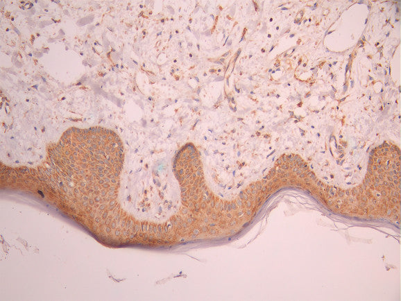 IHC image of CSB-RA272247A0HU diluted at 1:100 and staining in paraffin-embedded human skin tissue performed on a Leica BondTM system. After dewaxing and hydration, antigen retrieval was mediated by high pressure in a citrate buffer (pH 6.0). Section was blocked with 10% normal goat serum 30min at RT. Then primary antibody (1% BSA) was incubated at 4°C overnight. The primary is detected by a Goat anti-rabbit polymer IgG labeled by HRP and visualized using 0.05% DAB.