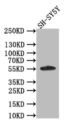 Western Blot
Positive WB detected in: SH-SY5Y whole cell lysate
All lanes: CD44 antibody at 1:1000
Secondary
Goat polyclonal to rabbit IgG at 1/50000 dilution
Predicted band size: 56 kDa
Observed band size: 56 kDa