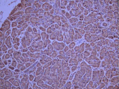 IHC image of CSB-RA272525A0HU diluted at 1:100 and staining in paraffin-embedded human pancreatic tissue performed on a Leica BondTM system. After dewaxing and hydration, antigen retrieval was mediated by high pressure in a citrate buffer (pH 6.0). Section was blocked with 10% normal goat serum 30min at RT. Then primary antibody (1% BSA) was incubated at 4°C overnight. The primary is detected by a Goat anti-rabbit polymer IgG labeled by HRP and visualized using 0.05% DAB.