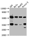 Western Blot
Positive WB detected in: 293 whole cell lysate, Hela whole cell lysate, HepG2 whole cell lysate, Ntera-2 whole cell lysate
All lanes: NONO Antibody at 1:1000
Secondary
Goat polyclonal to rabbit IgG at 1/50000 dilution
Predicted band size: 55, 44 kDa
Observed band size: 55 kDa