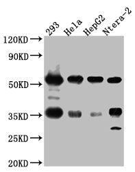 Western Blot
Positive WB detected in: 293 whole cell lysate, Hela whole cell lysate, HepG2 whole cell lysate, Ntera-2 whole cell lysate
All lanes: NONO Antibody at 1:1000
Secondary
Goat polyclonal to rabbit IgG at 1/50000 dilution
Predicted band size: 55, 44 kDa
Observed band size: 55 kDa