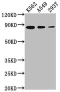 Western Blot
Positive WB detected in: K562 whole cell lysate, A549 whole cell lysate, 293T whole cell lysate
All lanes: XRCC5 antibody at 1:2000
Secondary
Goat polyclonal to rabbit IgG at 1/50000 dilution
Predicted band size: 83 kDa
Observed band size: 83 kDa