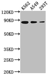Western Blot
Positive WB detected in: K562 whole cell lysate, A549 whole cell lysate, 293T whole cell lysate
All lanes: XRCC5 antibody at 1:2000
Secondary
Goat polyclonal to rabbit IgG at 1/50000 dilution
Predicted band size: 83 kDa
Observed band size: 83 kDa