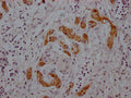 MDK Antibody – Figure 1 of 1