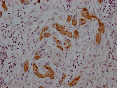 MDK Antibody – Figure 1 of 1