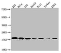 Western Blot
Positive WB detected in: 293 whole cell lysate, Hela whole cell lysate, L02 whole cell lysate, HepF2 whole cell lysate, Raji whole cell lysate, Jurkat whole cell lysate, K562 whole cell lysate
All lanes: TOMM22 antibody at 1:1000
Secondary
Goat polyclonal to rabbit IgG at 1/50000 dilution
Predicted band size: 16 kDa
Observed band size: 18 kDa
