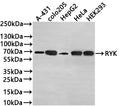 Western Blot
Positive WB detected in: A-431 whole cell lysate(30µg) , COLO205 whole cell lysate(30µg) , HepG2 whole cell lysate(30µg) , HeLa whole cell lysate(30µg) , HEK293 whole cell lysate(30µg) 
All lanes: RYK antibody at 1:1000
Secondary
Goat polyclonal to rabbit IgG at 1/50000 dilution
Predicted band size: 68 kDa
Observed band size: 68 kDa
Exposure time: 3min
