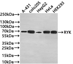 Western Blot
Positive WB detected in: A-431 whole cell lysate(30µg) , COLO205 whole cell lysate(30µg) , HepG2 whole cell lysate(30µg) , HeLa whole cell lysate(30µg) , HEK293 whole cell lysate(30µg) 
All lanes: RYK antibody at 1:1000
Secondary
Goat polyclonal to rabbit IgG at 1/50000 dilution
Predicted band size: 68 kDa
Observed band size: 68 kDa
Exposure time: 3min