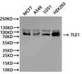 Western Blot
Positive WB detected in: MCF7 whole cell lysate(30µg), A549 whole cell lysate(30µg), U251 whole cell lysate(30µg), HEK293 whole cell lysate(30µg)
All lanes: TLE1 antibody at 1:1000
Secondary
Goat polyclonal to rabbit IgG at 1/40000 dilution
Predicted band size: 83 kDa
Observed band size: 83 kDa
Exposure time：2min