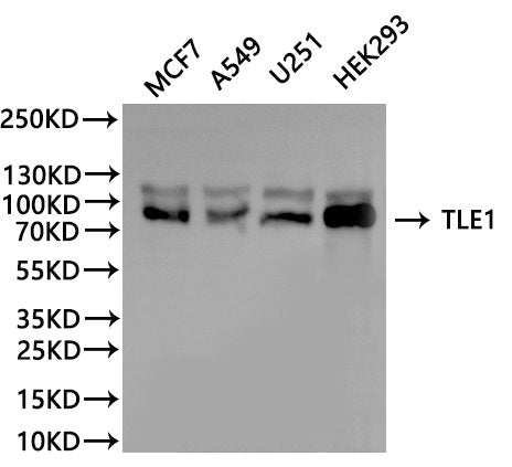 Western Blot
Positive WB detected in: MCF7 whole cell lysate(30µg), A549 whole cell lysate(30µg), U251 whole cell lysate(30µg), HEK293 whole cell lysate(30µg)
All lanes: TLE1 antibody at 1:1000
Secondary
Goat polyclonal to rabbit IgG at 1/40000 dilution
Predicted band size: 83 kDa
Observed band size: 83 kDa
Exposure time：2min