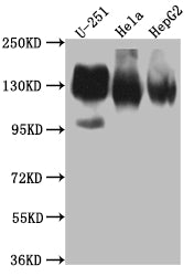 Western Blot
Positive WB detected in: U-251 whole cell lysate, Hela whole cell lysate, HepG2 whole cell lysate
All lanes: ITGAV antibody at 1:1000
Secondary
Goat polyclonal to rabbit IgG at 1/50000 dilution
Predicted band size: 117, 113, 112 kDa
Observed band size: 130 kDa