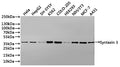 Western Blot Positive WB detected in: Hela whole cell lysate(30µg), HepG2 whole cell lysate(30µg), SH-SY5Y whole cell lysate(30µg), K562 whole cell lysate(30µg), whole cell lysate(30µg), COLO-205 whole cell lysate(30µg), HEK293 whole cell lysate(30µg), NIH/3T3 whole cell lysate(30µg), MCF-7 whole cell lysate(30µg), A431 whole cell lysate(30µg) All lanes: Syntaxin 3 antibody at 1:1000 Secondary Goat polyclonal to rabbit IgG at 1/40000 dilution Predicted band size: 33 kDa Observed band size: 36 kDa Exposure…