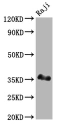 POU2AF1 Antibody – Figure 1 of 3