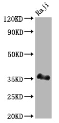 POU2AF1 Antibody – Figure 1 of 3