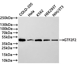 Western Blot
Positive WB detected in:COLO-205 whole cell lysate(30µg) , Hela whole cell lysate(30µg) , K562 whole cell lysate(30µg) , HEK293T whole cell lysate(30µg) , NIH/3T3 whole cell lysate(30µg) 
All lanes: GTF2F2 antibody at 1:1000
Secondary
Goat polyclonal to rabbit IgG at 1/40000 dilution
Predicted band size: 28 kDa
Observed band size: 30 kDa
Exposure time：3min