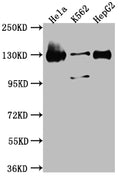 Western Blot
Positive WB detected in: Hela whole cell lysate, K562 whole cell lysate, HepG2 whole cell lysate
All lanes: Bub1 antibody at 1:1000
Secondary
Goat polyclonal to rabbit IgG at 1/50000 dilution
Predicted band size: 123, 116, 120 kDa
Observed band size: 130 kDa
