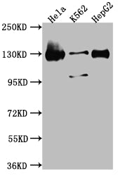 Western Blot
Positive WB detected in: Hela whole cell lysate, K562 whole cell lysate, HepG2 whole cell lysate
All lanes: Bub1 antibody at 1:1000
Secondary
Goat polyclonal to rabbit IgG at 1/50000 dilution
Predicted band size: 123, 116, 120 kDa
Observed band size: 130 kDa