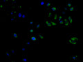 Immunofluorescence staining of Hela cell with CSB-RA282889A0HU at 1:50, counter-stained with DAPI. The cells were fixed in 4% formaldehyde and blocked in 10% normal Goat Serum. The cells were then incubated with the antibody overnight at 4°C. The secondary antibody was Alexa Fluor 488-congugated AffiniPure Goat Anti-Rabbit IgG(H+L) .