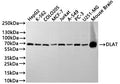Western Blot
Positive WB detected in: HepG2 whole cell lysate(30µg), K562 whole cell lysate(30µg), COLO205 whole cell lysate(30µg), MCF7 whole cell lysate(30µg), Jurkat whole cell lysate(30µg), A549 whole cell lysate(30µg), PC-3 whole cell lysate(30µg), U251 whole cell lysate(30µg), Mouse brain tissue lysate(30µg)
All lanes:DLAT antibody at 1:1000
Secondary
Goat polyclonal to rabbit IgG at 1/40000 dilution
Predicted band size: 69 kDa
Observed band size: 69 kDa
Exposure time：2min