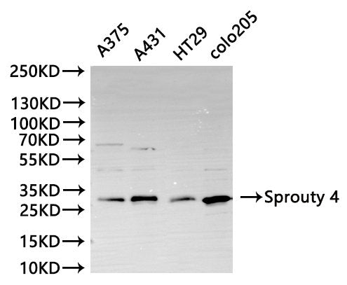 Western Blot
Positive WB detected in: A375 whole cell lysate(30µg), A431 whole cell lysate(30µg), HT29 whole cell lysate(30µg), colo205 whole cell lysate(30µg)
All lanes: Sprouty 4 antibody at 1:1000
Secondary
Goat polyclonal to rabbit IgG at 1/40000 dilution
Predicted band size: 33 kDa
Observed band size: 33 kDa
Exposure time：10s
