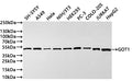 Western Blot
Positive WB detected in: HEK293 whole cell lysate(30µg) , HepG2 whole cell lysate(30µg) , LO2 whole cell lysate(30µg) , Hela whole cell lysate(30µg) , A549 whole cell lysate(30µg) , Raji whole cell lysate(30µg) , U-87MG whole cell lysate(30µg) , Mouse brain tissue lysate(30µg) , Rat brain tissue lysate(30µg) 
All lanes: GOT1 antibody at 1:1000
Secondary
Goat polyclonal to rabbit IgG at 1/40000 dilution
Predicted band size: 46 kDa
Observed band size: 46 kDa
Exposure time：2min
