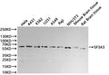 Western Blot
Positive WB detected in: Hela whole cell lysate(30µg), A431 whole cell lysate(30µg), K562 whole cell lysate(30µg), U-251MG whole cell lysate(30µg), A549 whole cell lysate(30µg), Raji whole cell lysate(30µg), NIH/3T3 whole cell lysate(30µg), Mouse brain tissue lysate(30µg), Rat brain tissue lysate(30µg)
All lanes: SF3A3 antibody at 1:1000
Secondary
Goat polyclonal to rabbit IgG at 1/40000 dilution
Predicted band size: 59 kDa
Observed band size: 59 kDa
Exposure time：20s