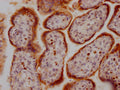 IHC image of CSB-RA285852A0HU diluted at 1:100 and staining in paraffin-embedded human placenta tissue performed on a Leica BondTM system. After dewaxing and hydration, antigen retrieval was mediated by high pressure in a citrate buffer (pH 6.0) . Section was blocked with 10% normal goat serum 30min at RT. Then primary antibody (1% BSA) was incubated at 4℃ overnight. The primary is detected by a Goat anti-rabbit IgG polymer labeled by HRP and visualized using 0.05% DAB.
