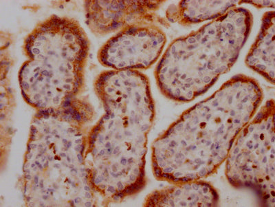 IHC image of CSB-RA285852A0HU diluted at 1:100 and staining in paraffin-embedded human placenta tissue performed on a Leica BondTM system. After dewaxing and hydration, antigen retrieval was mediated by high pressure in a citrate buffer (pH 6.0) . Section was blocked with 10% normal goat serum 30min at RT. Then primary antibody (1% BSA) was incubated at 4℃ overnight. The primary is detected by a Goat anti-rabbit IgG polymer labeled by HRP and visualized using 0.05% DAB.