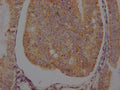 ADRB2 Antibody – Figure 1 of 2