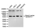 Western Blot
Positive WB detected in: A431 whole cell lysate(30µg), THP-1 whole cell lysate(30µg), HEK293 whole cell lysate(30µg), NIH/3T3 whole cell lysate(30µg)
All lanes:Sterol carrier protein 2 antibody at 1:1000
Secondary
Goat polyclonal to rabbit IgG at 1/40000 dilution
Predicted band size: 59 kDa
Observed band size: 59 kDa
Exposure time：1min