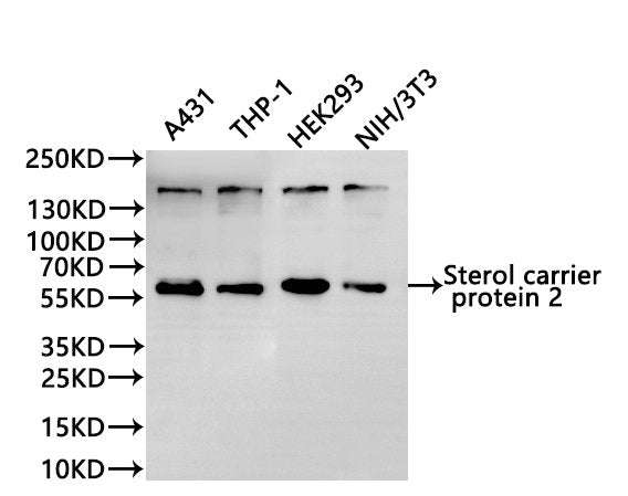Western Blot
Positive WB detected in: A431 whole cell lysate(30µg), THP-1 whole cell lysate(30µg), HEK293 whole cell lysate(30µg), NIH/3T3 whole cell lysate(30µg)
All lanes:Sterol carrier protein 2 antibody at 1:1000
Secondary
Goat polyclonal to rabbit IgG at 1/40000 dilution
Predicted band size: 59 kDa
Observed band size: 59 kDa
Exposure time：1min