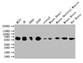 Western Blot
Positive WB detected in: MCF7 whole cell lysate,JK whole cell lysate, K562 whole cell lysate,A549 whole cell lysate, ntera2 whole cell lysate, Mouse Heart tissue lysate, Mouse Skeletal Muscle tissue lysate, Mouse Brain tissue lysate, Rat Brain tissue lysate
All lanes: PAK1 antibody at 1:1000
Secondary
Goat polyclonal to rabbit IgG at 1/50000 dilution
Predicted band size: 61 kDa
Observed band size: 61 kDa