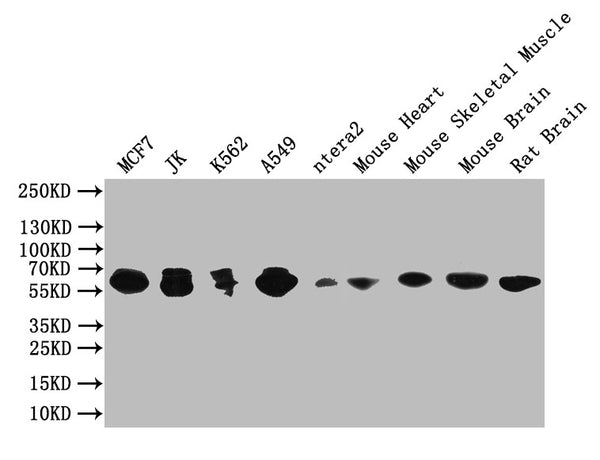 Western Blot
Positive WB detected in: MCF7 whole cell lysate,JK whole cell lysate, K562 whole cell lysate,A549 whole cell lysate, ntera2 whole cell lysate, Mouse Heart tissue lysate, Mouse Skeletal Muscle tissue lysate, Mouse Brain tissue lysate, Rat Brain tissue lysate
All lanes: PAK1 antibody at 1:1000
Secondary
Goat polyclonal to rabbit IgG at 1/50000 dilution
Predicted band size: 61 kDa
Observed band size: 61 kDa