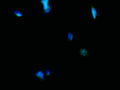 Immunofluorescence staining of SH-SY5Y cell with CSB-RA287871A0HU at 1:50 , counter-stained with DAPI. The cells were fixed in 4% formaldehyde, permeabilized using 0.2% Triton X-100 and blocked in 10% normal Goat Serum. The cells were then incubated with the antibody overnight at 4°C. The secondary antibody was Alexa Fluor 488-congugated AffiniPure Goat Anti-Rabbit IgG(H+L).
