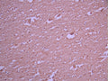 IHC image of CSB-RA288465A0HU diluted at 1:100 and staining in paraffin-embedded human brain tissue performed on a Leica BondTM system. After dewaxing and hydration, antigen retrieval was mediated by high pressure in a citrate buffer (pH 6.0). Section was blocked with 10% normal goat serum 30min at RT. Then primary antibody (1% BSA) was incubated at 4°C overnight. The primary is detected by a Goat anti-rabbit polymer IgG labeled by HRP and visualized using 0.05% DAB.