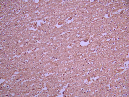IHC image of CSB-RA288465A0HU diluted at 1:100 and staining in paraffin-embedded human brain tissue performed on a Leica BondTM system. After dewaxing and hydration, antigen retrieval was mediated by high pressure in a citrate buffer (pH 6.0). Section was blocked with 10% normal goat serum 30min at RT. Then primary antibody (1% BSA) was incubated at 4°C overnight. The primary is detected by a Goat anti-rabbit polymer IgG labeled by HRP and visualized using 0.05% DAB.
