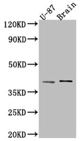 Western Blot
Positive WB detected in: U-87 whole cell lysate, Rat Brain whole cell lysate
All lanes: NGF antibody at 1:1000
Secondary
Goat polyclonal to rabbit IgG at 1/50000 dilution
Predicted band size: 27 kDa
Observed band size: 39 kDa