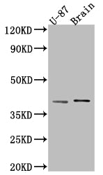 Western Blot
Positive WB detected in: U-87 whole cell lysate, Rat Brain whole cell lysate
All lanes: NGF antibody at 1:1000
Secondary
Goat polyclonal to rabbit IgG at 1/50000 dilution
Predicted band size: 27 kDa
Observed band size: 39 kDa