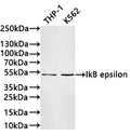 Western Blot
Positive WB detected in: THP-1 whole cell lysate(30µg) , K562 whole cell lysate(30µg) 
All lanes: IkB epsilon antibody at 1:1000
Secondary
Goat polyclonal to rabbit IgG at 1/40000 dilution
Predicted band size: 53 kDa
Observed band size: 53 kDa
Exposure time：1min40s