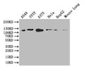 Western Blot
Positive WB detected in: A549 whole cell lysate, SY5Y whole cell lysate, A375 whole cell lysate, HEPG2 whole cell lysate, Mouse Lung tissue lysate
All lanes: DDR2 antibody at 1:1000
Secondary
Goat polyclonal to rabbit IgG at 1/50000 dilution
Predicted band size: 96 kDa
Observed band size: 110 kDa