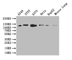 Western Blot
Positive WB detected in: A549 whole cell lysate, SY5Y whole cell lysate, A375 whole cell lysate, HEPG2 whole cell lysate, Mouse Lung tissue lysate
All lanes: DDR2 antibody at 1:1000
Secondary
Goat polyclonal to rabbit IgG at 1/50000 dilution
Predicted band size: 96 kDa
Observed band size: 110 kDa