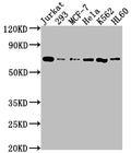 Western Blot
Positive WB detected in: Jurkat whole cell lysate, 293 whole cell lysate, MCF-7 whole cell lysate, Hela whole cell lysate, K562 whole cell lysate, HL60 whole cell lysate
All lanes: PTPN11 antibody at 1:2000
Secondary
Goat polyclonal to rabbit IgG at 1/50000 dilution
Predicted band size: 69, 53 kDa
Observed band size: 69 kDa