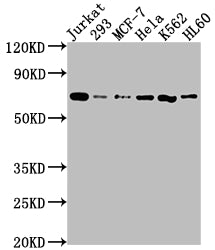 Western Blot
Positive WB detected in: Jurkat whole cell lysate, 293 whole cell lysate, MCF-7 whole cell lysate, Hela whole cell lysate, K562 whole cell lysate, HL60 whole cell lysate
All lanes: PTPN11 antibody at 1:2000
Secondary
Goat polyclonal to rabbit IgG at 1/50000 dilution
Predicted band size: 69, 53 kDa
Observed band size: 69 kDa