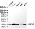 Western Blot
Positive WB detected in: HEK293 whole cell lysate(30µg) , Hela whole cell lysate(30µg) , HepG2 whole cell lysate(30µg) , A431 whole cell lysate(30µg) , MCF-7 whole cell lysate(30µg) 
All lanes: IFITM3 antibody at 1:1000
Secondary
Goat polyclonal to rabbit IgG at 1/40000 dilution
Predicted band size: 15 kDa
Observed band size: 15 kDa
Exposure time：40s