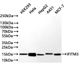 Western Blot
Positive WB detected in: HEK293 whole cell lysate(30µg) , Hela whole cell lysate(30µg) , HepG2 whole cell lysate(30µg) , A431 whole cell lysate(30µg) , MCF-7 whole cell lysate(30µg) 
All lanes: IFITM3 antibody at 1:1000
Secondary
Goat polyclonal to rabbit IgG at 1/40000 dilution
Predicted band size: 15 kDa
Observed band size: 15 kDa
Exposure time：40s
