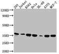 Western Blot
Positive WB detected in: 293 whole cell lysate, Jurkat whole cell lysate, K562 whole cell lysate, Hela whole cell lysate, HL-60 whole cell lysate, A375 whole cell lysate, MCF-7 whole cell lysate
All lanes: Syntaxin 4 antibody at 1:1000
Secondary
Goat polyclonal to rabbit IgG at 1/50000 dilution
Predicted band size: 35, 34 kDa
Observed band size: 35 kDa