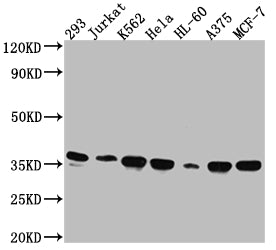 Western Blot
Positive WB detected in: 293 whole cell lysate, Jurkat whole cell lysate, K562 whole cell lysate, Hela whole cell lysate, HL-60 whole cell lysate, A375 whole cell lysate, MCF-7 whole cell lysate
All lanes: Syntaxin 4 antibody at 1:1000
Secondary
Goat polyclonal to rabbit IgG at 1/50000 dilution
Predicted band size: 35, 34 kDa
Observed band size: 35 kDa