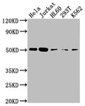 Western Blot
Positive WB detected in: Hela whole cell lysate, Jurkat whole cell lysate, HL60 whole cell lysate, 293T whole cell lysate, K562 whole cell lysate
All lanes: CASP2 antibody at 1:2000
Secondary
Goat polyclonal to rabbit IgG at 1/50000 dilution
Predicted band size: 51, 35, 11 kDa
Observed band size: 51 kDa
