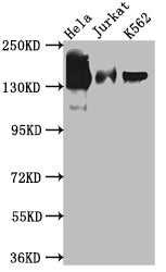 Western Blot
Positive WB detected in: Hela whole cell lysate, Jurkat whole cell lysate, K562 whole cell lysate
All lanes: SA2 antibody at 1:1000
Secondary
Goat polyclonal to rabbit IgG at 1/50000 dilution
Predicted band size: 142, 146 kDa
Observed band size: 142 kDa